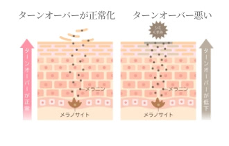 お肌の正常化